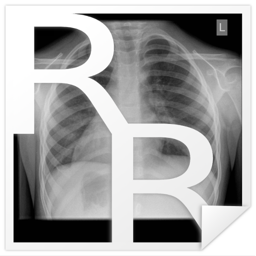 Radiology Cases: Chest