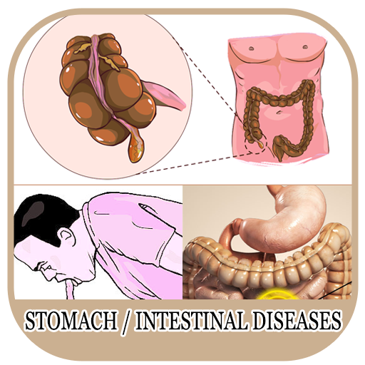 All Stomach Disease &Treatment